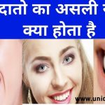 प्राकृतिक रूप से पीले दांत साफ करने के तरीके