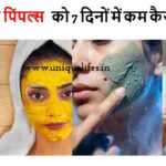 घर पर पिंपल्स को 7 दिनों में कम कैसे करें? 7 Days Challenge for Clear Skin